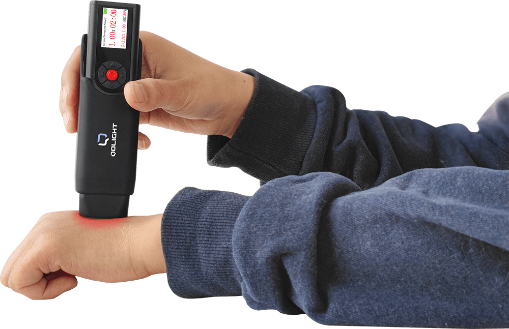Micura Handheld Therapy Laser Treatment